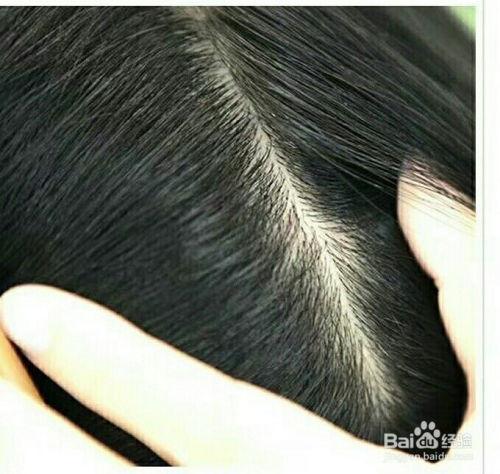 头皮护理爆料怎么做视频,打造健康秀发，视频教程一网打尽